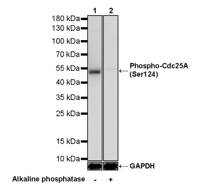 Phospho-Cdc25A (Ser124) Recombinant Rabbit mAb (S-5057-5)