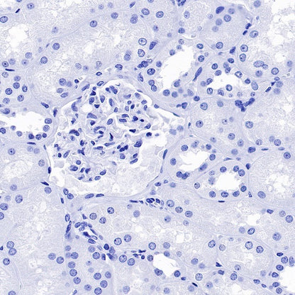 DDX4 Recombinant Rabbit mAb (S-1570-48)