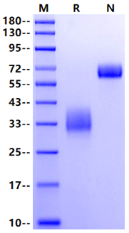 LOX-1/OLR1 His Tag Protein, Human