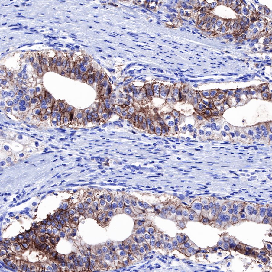 Claudin18.2 Recombinant Rabbit mAb,PBS Only (SDT-102-24)