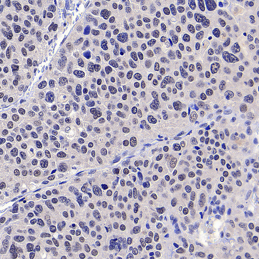 PAPSS1 Recombinant Rabbit mAb (S-3516-9)