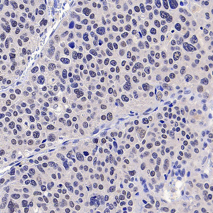 PAPSS1 Recombinant Rabbit mAb (S-3516-9)