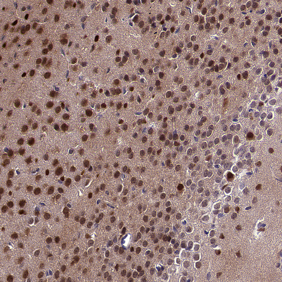 ACSS2 Recombinant Rabbit mAb (S-4117-9)