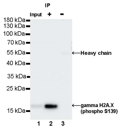 Phospho-gamma H2A.X (Ser139) Recombinant Rabbit mAb (S-981-56)