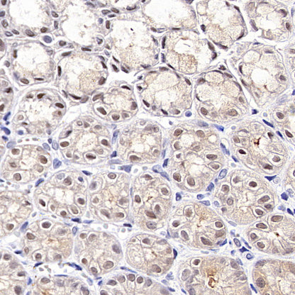 Tug Recombinant Rabbit mAb (S-4377-21)