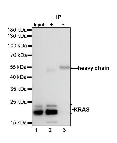 KRAS Recombinant Rabbit mAb (S-R291)
