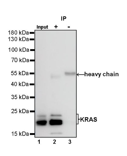 KRAS Recombinant Rabbit mAb (S-R291)
