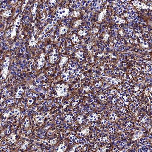 ICAM-1/CD54 Recombinant Rabbit mAb (S-906-48)