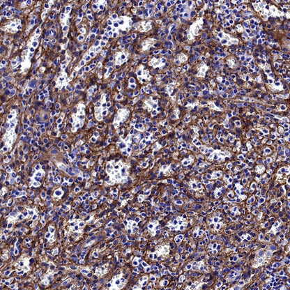 ICAM-1/CD54 Recombinant Rabbit mAb (S-906-48)