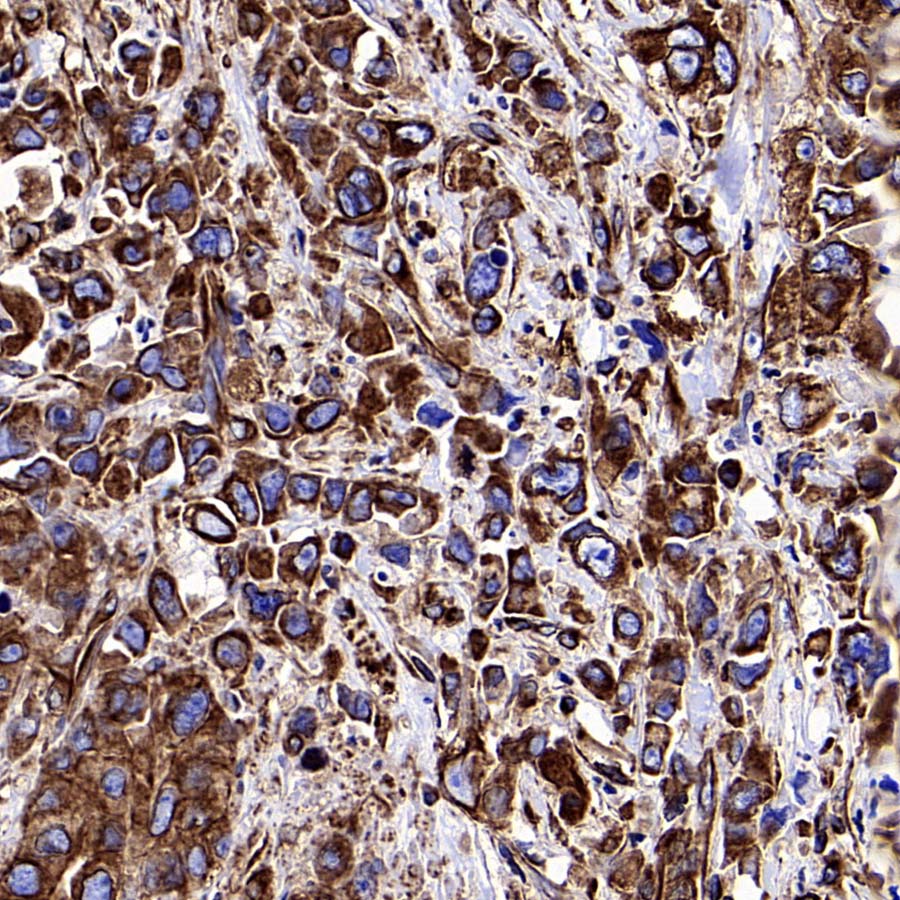 Beta III Tubulin Recombinant Rabbit mAb (S-5529)