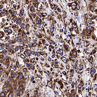 Beta III Tubulin Recombinant Rabbit mAb (S-5529)