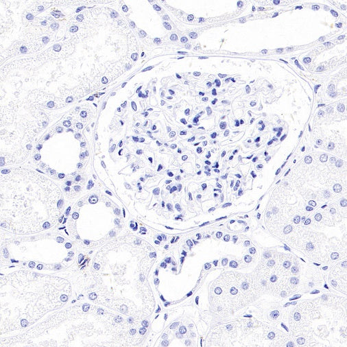 MDR3 Recombinant Rabbit mAb (SDT-1949-60)