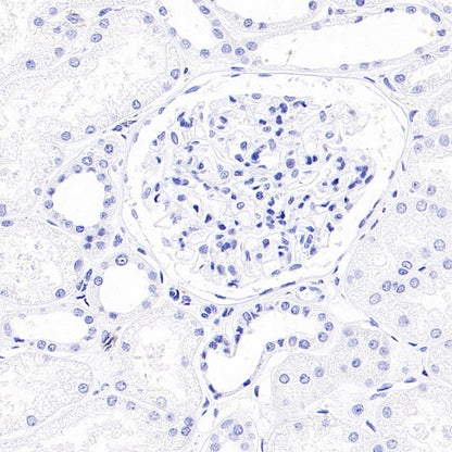 MDR3 Recombinant Rabbit mAb (SDT-1949-60)