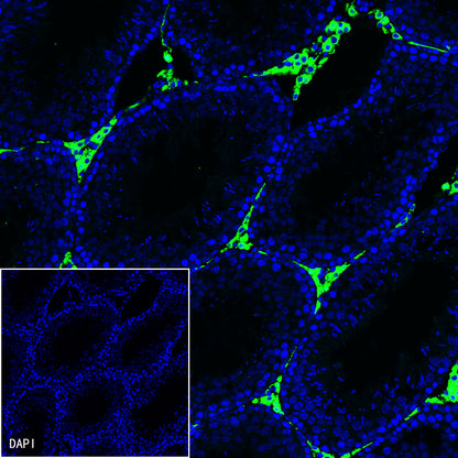 iNOS Recombinant Rabbit mAb (SDT-R131)