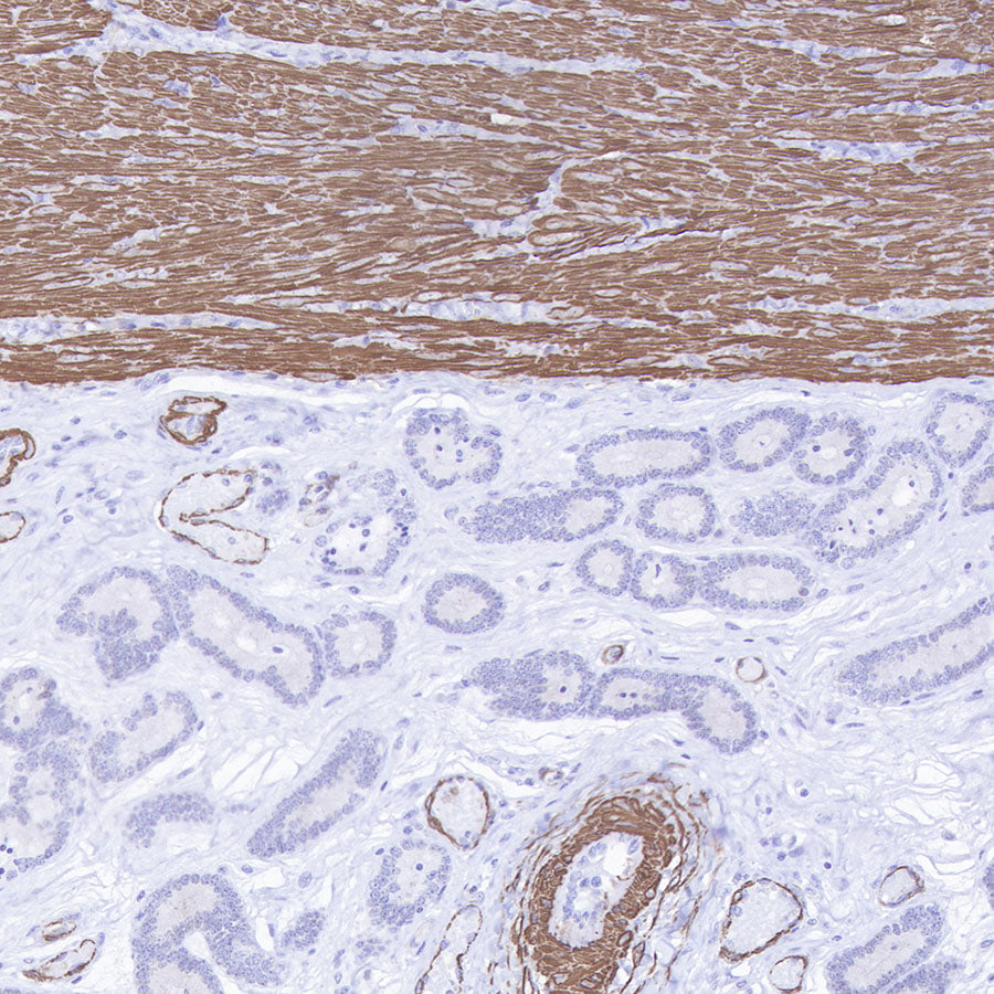 S-RMab® alpha smooth muscle Actin (SMA) Recombinant Rabbit mAb (SDT-301-142)