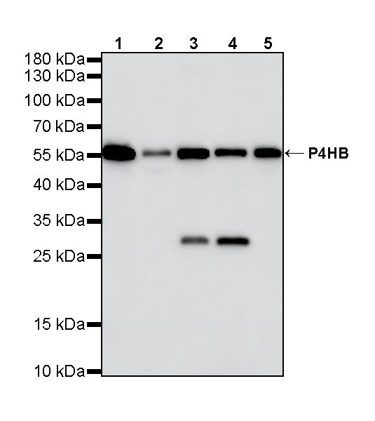 P4HB Recombinant Rabbit mAb
