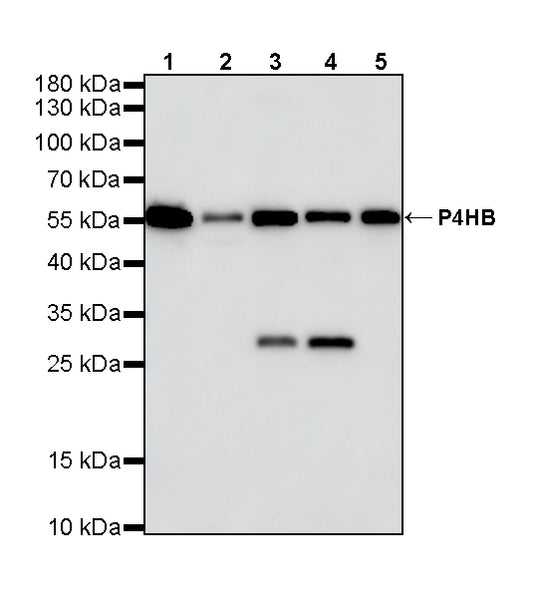 P4HB Recombinant Rabbit mAb