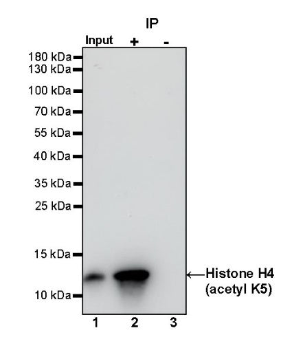 Histone H4 (acetyl K5) Recombinant Rabbit mAb (S-1464-112)