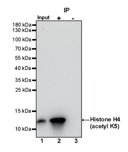 Histone H4 (acetyl K5) Recombinant Rabbit mAb (S-1464-112)