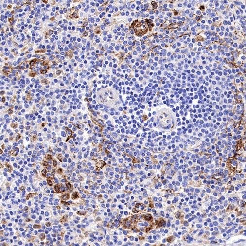 Apolipoprotein E/APOE Recombinant Rabbit mAb (S-970-75)