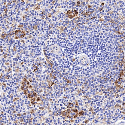Apolipoprotein E/APOE Recombinant Rabbit mAb (S-970-75)