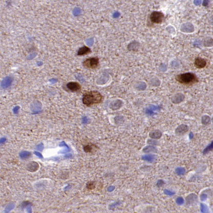 Phospho-α-Synuclein (Ser129) Recombinant Rabbit mAb (SDT-3397)