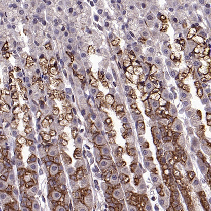 Anterior Gradient 2 Rabbit Polyclonal Antibody