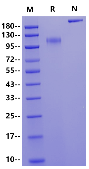 E-Selectin/CD62E Fc Chimera Protein, Human