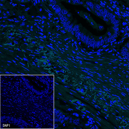 PDGFRA+PDGFRB Recombinant Rabbit mAb (S-393-11)