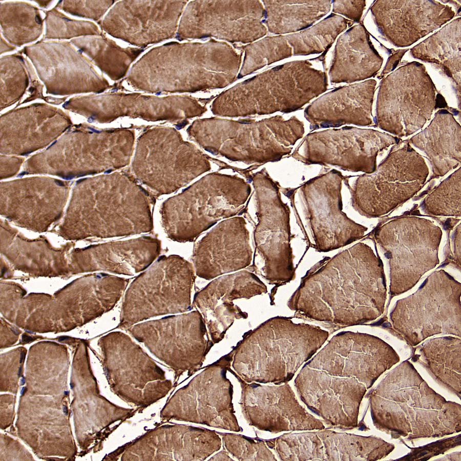 Aldolase A Recombinant Rabbit mAb (S-4007-23)