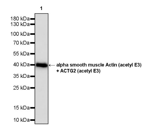 alpha smooth muscle Actin (acetyl E3) + ACTG2 (acetyl E3) Recombiant Rabbit mAb (S-3355)