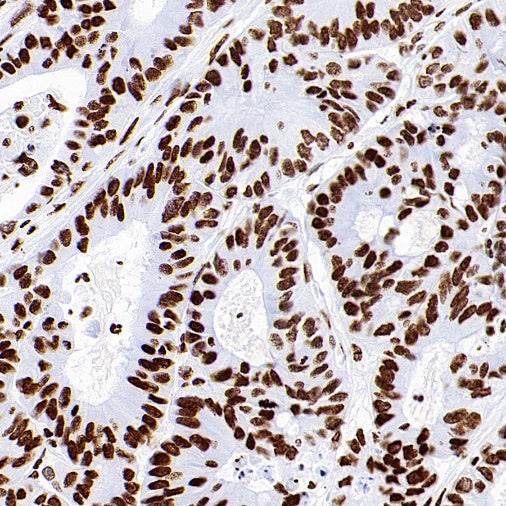 Histone H3 (acetyl K18) Recombinant Rabbit mAb (S-1688-90)