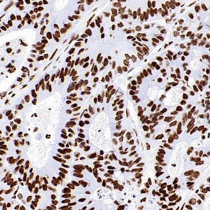 Histone H3 (acetyl K18) Recombinant Rabbit mAb (S-1688-90)