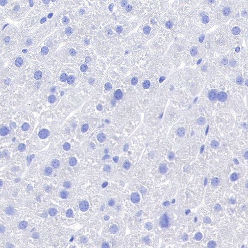 TBR1 Recombinant Rabbit mAb (S-1102-34)