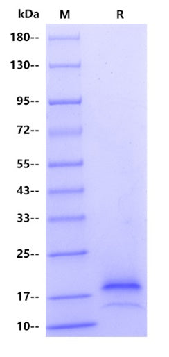 Rat IgG lambda1 Protein, His Tag