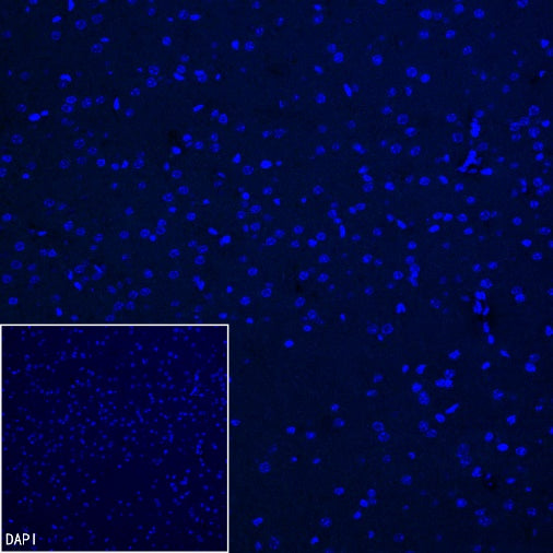Coagulation factor V Recombinant Rabbit mAb (S-4489-58)