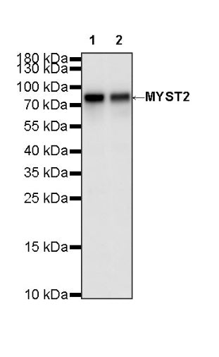 MYST2 Recombinant Rabbit mAb (S-3730-123)