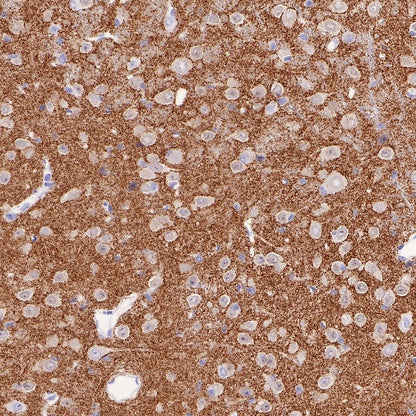 α/β-Synuclein Recombinant Rabbit mAb (S-309-72)