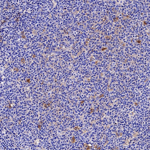 AACT Recombinant Rabbit mAb (S-897-109)