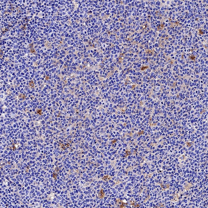 AACT Recombinant Rabbit mAb (S-897-109)