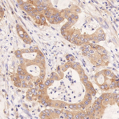 FXR1 Rabbit Polyclonal Antibody