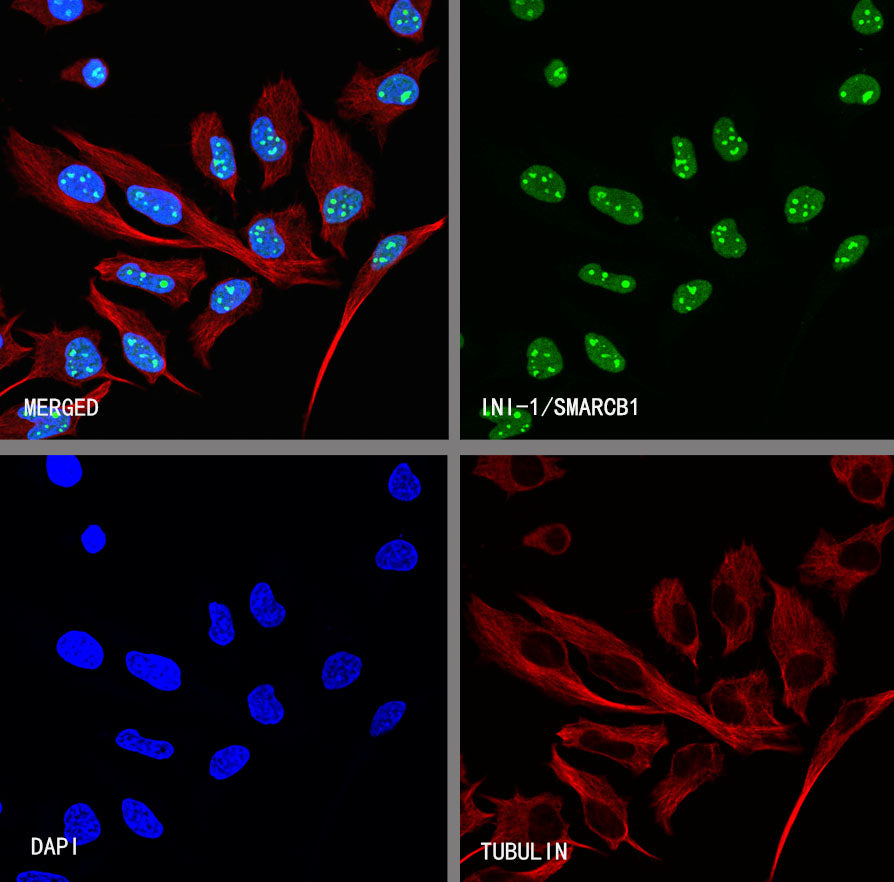INI-1/SMARCB1 Recombinant Rabbit mAb (S-4068-21)