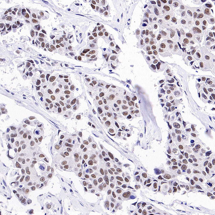 Phospho-ATM (Ser1981) Recombinant Rabbit mAb (S-3396)