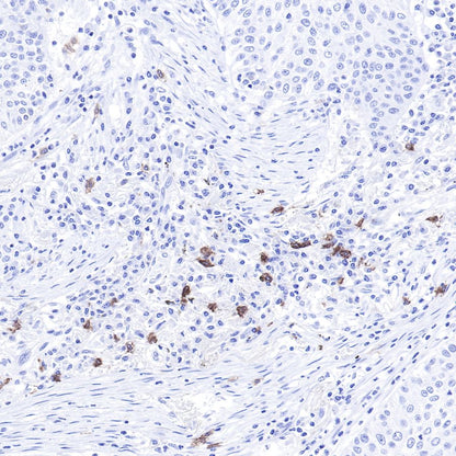S-RMab® CD117 Recombinant Rabbit mAb,PBS Only (SDT-125-51)