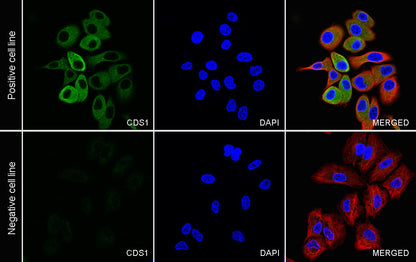 CDS1 Recombinant Rabbit mAb (S-3671-30)