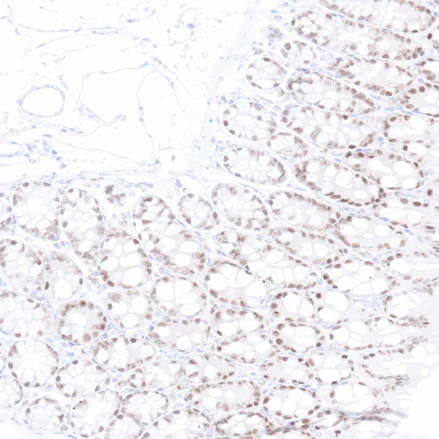 CDX2 Recombinant Rabbit mAb (SDT-134-76)