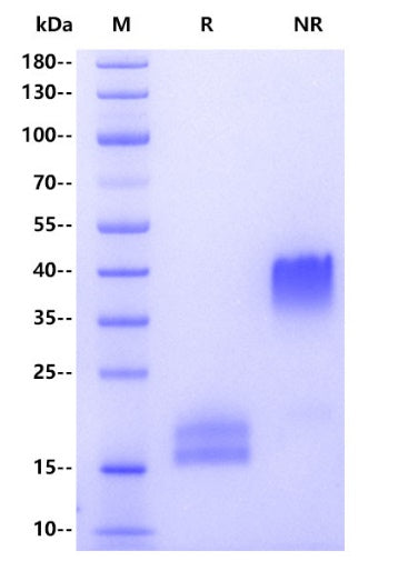 Rat TSH/CGA&TSHB Protein, His Tag