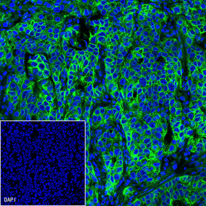 S-RMab®B7-H3/CD276 Recombinant Rabbit mAb (SDT-R158)