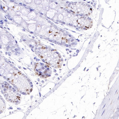 TOP2A Recombinant Rabbit mAb (S-513-107)