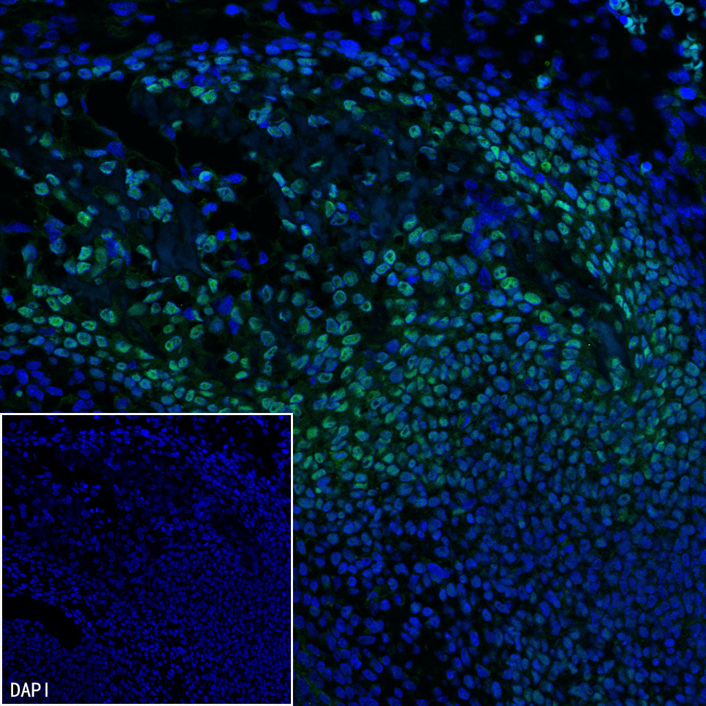 Sp7/Osterix Recombinant Rabbit mAb (S-4225-14)